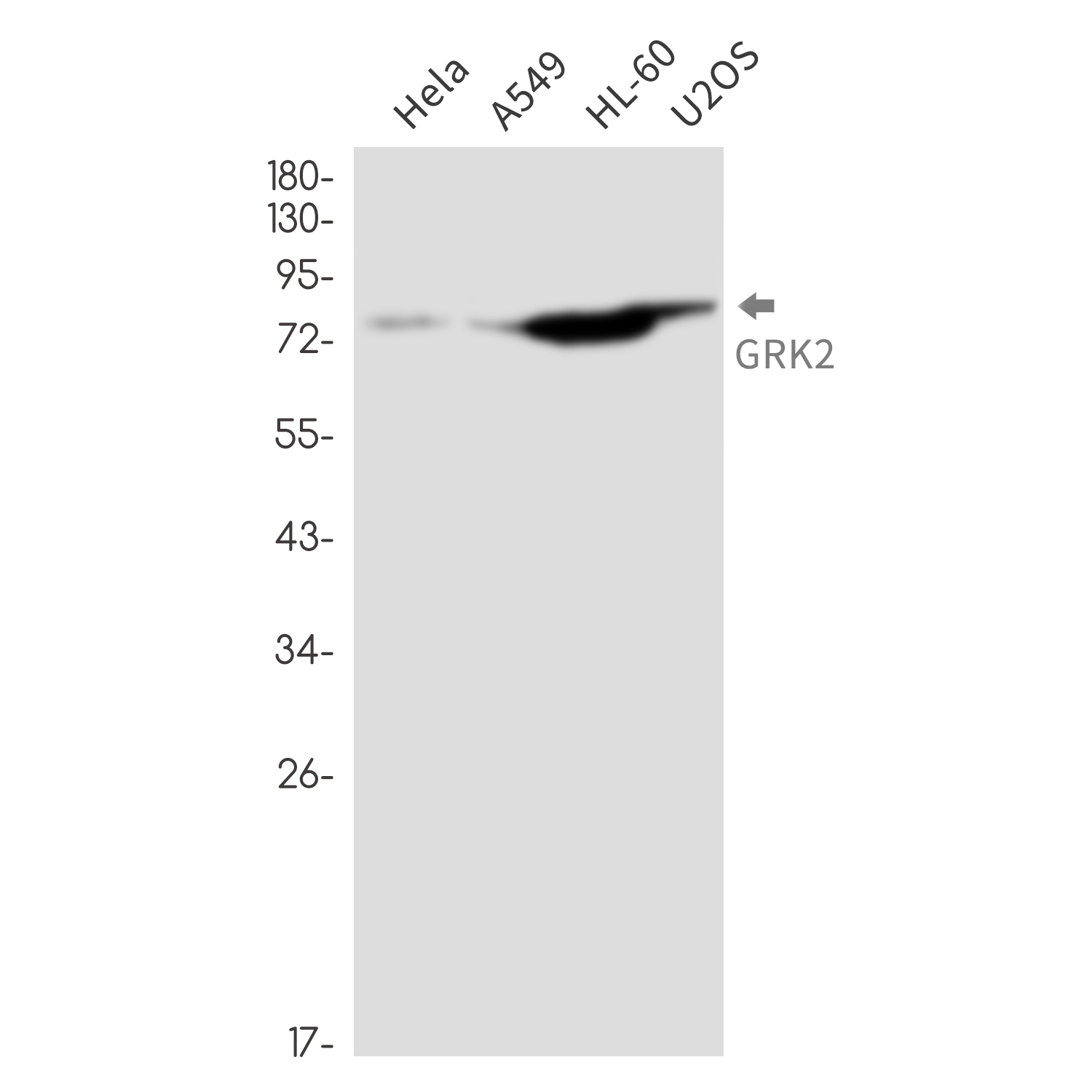 GRK2 Rabbit mAb ABZ2635