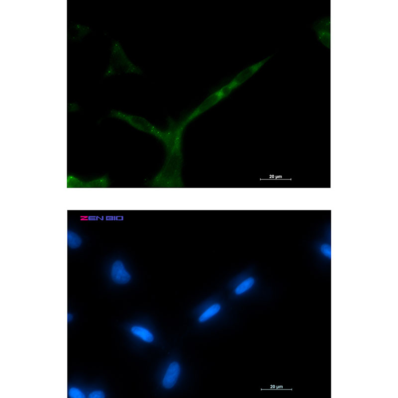 APC Rabbit mAb ABZ2636