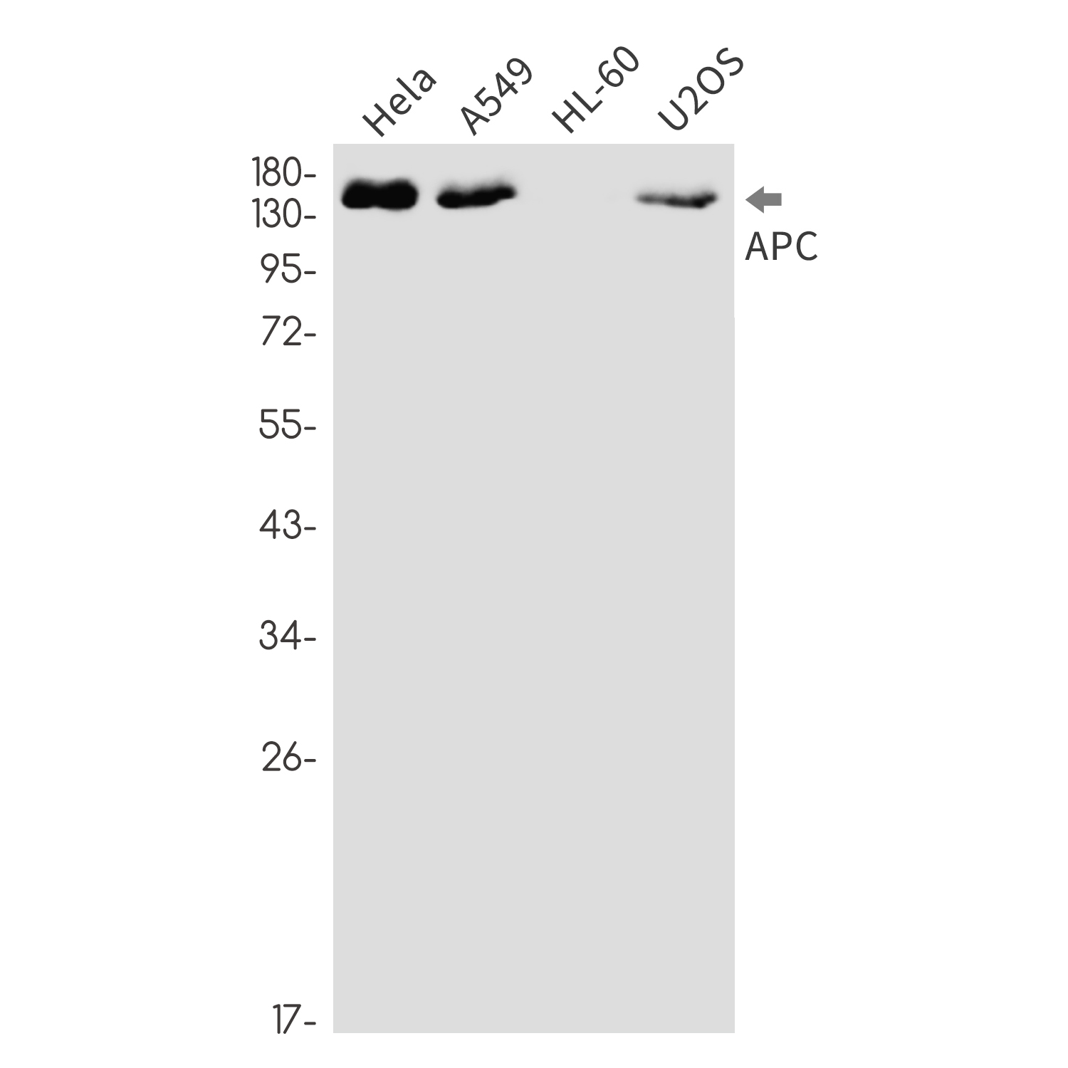 APC Rabbit mAb ABZ2636