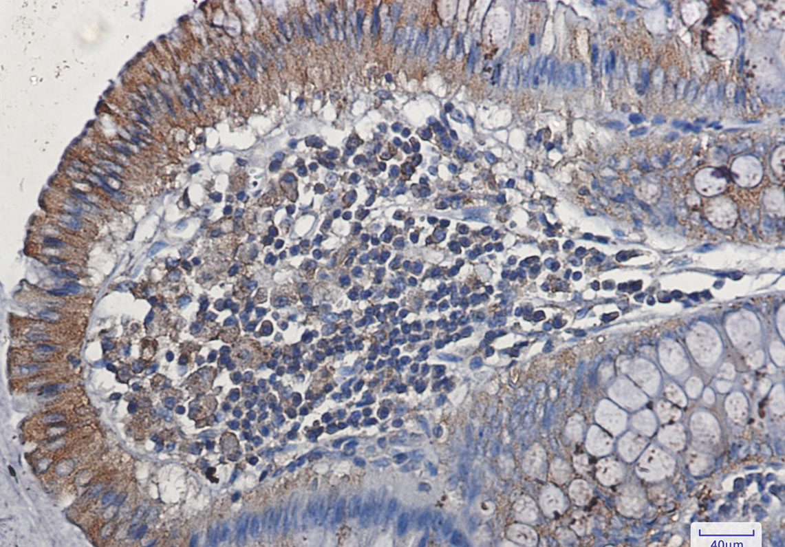 VEGF Receptor 1 Rabbit mAb ABZ2637