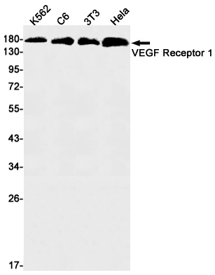 VEGF Receptor 1 Rabbit mAb ABZ2637