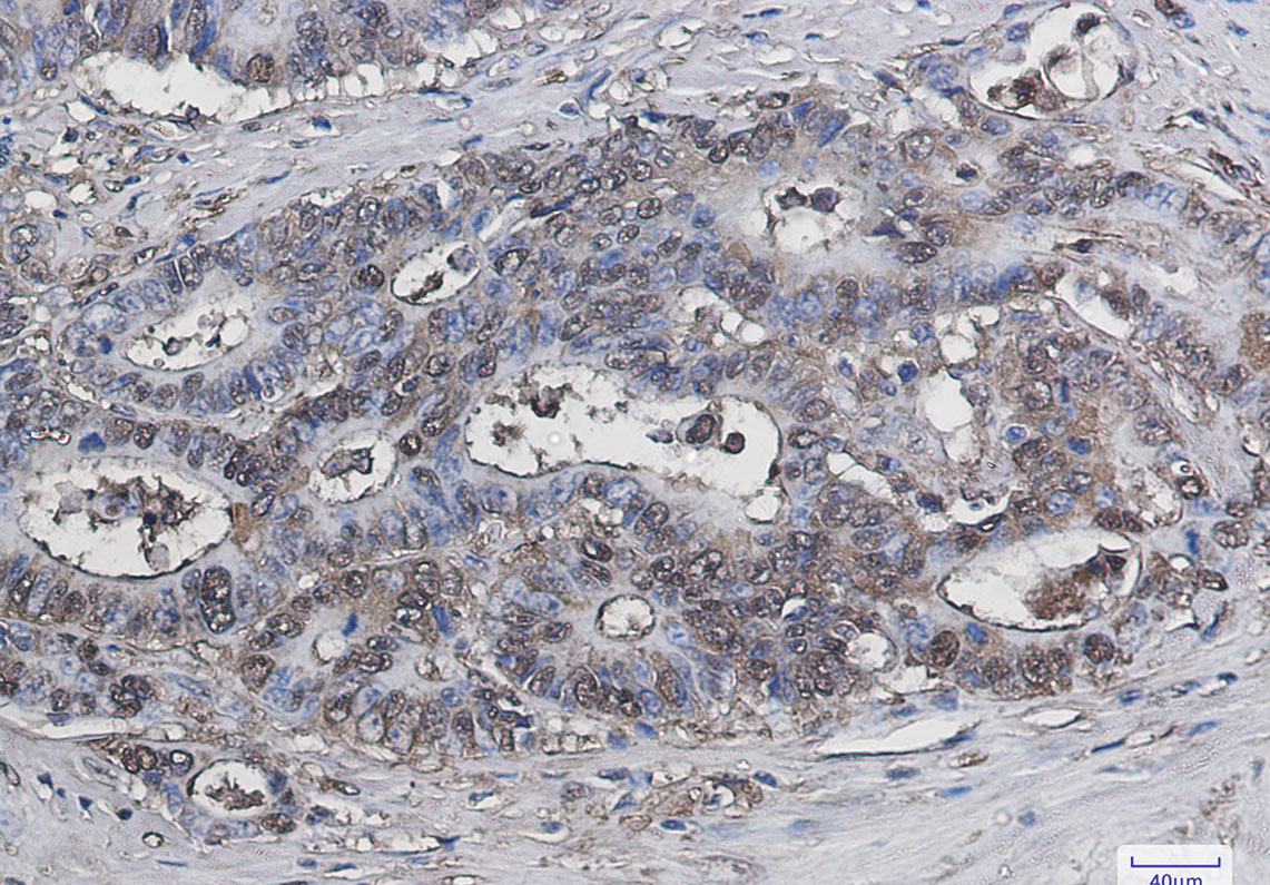 Galectin 3 Rabbit mAb ABZ2639