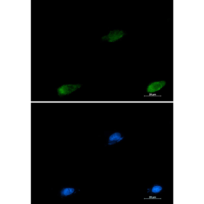 Galectin 3 Rabbit mAb ABZ2640