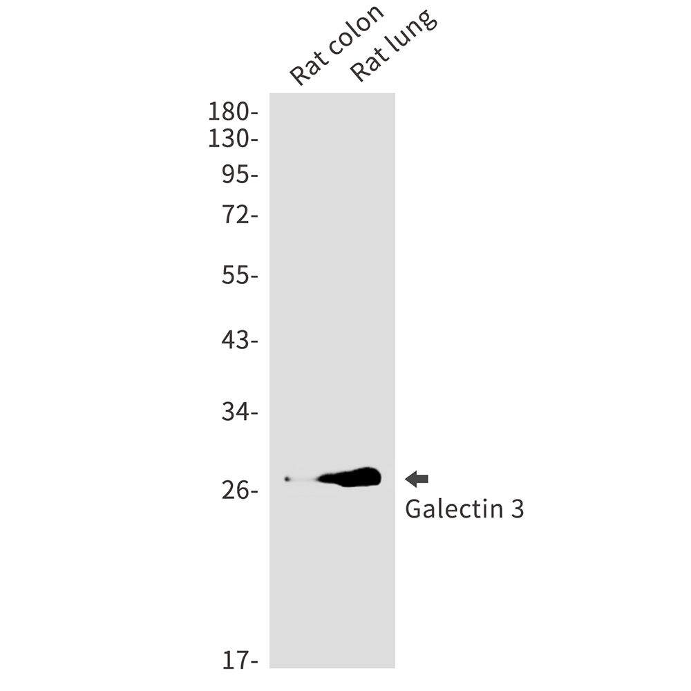 Galectin 3 Rabbit mAb ABZ2640