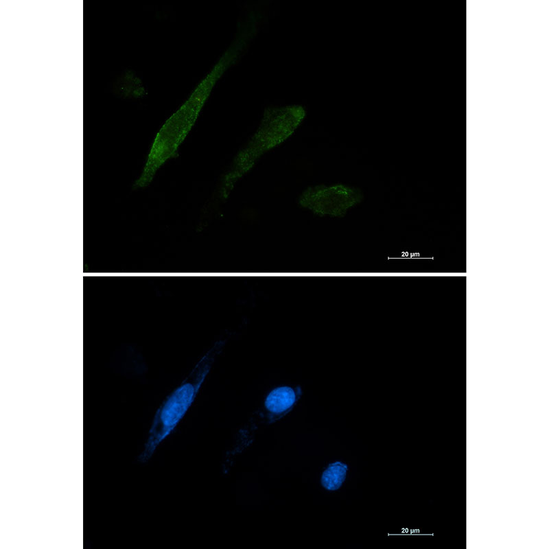 Galectin 3 Rabbit mAb ABZ2641