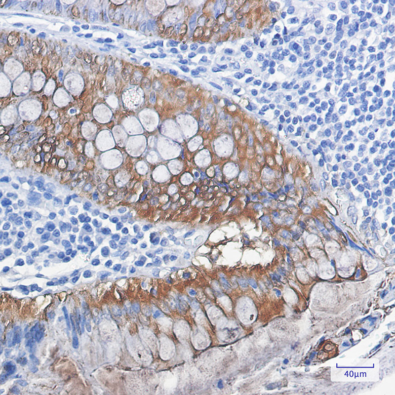 Galectin 3 Rabbit mAb ABZ2641