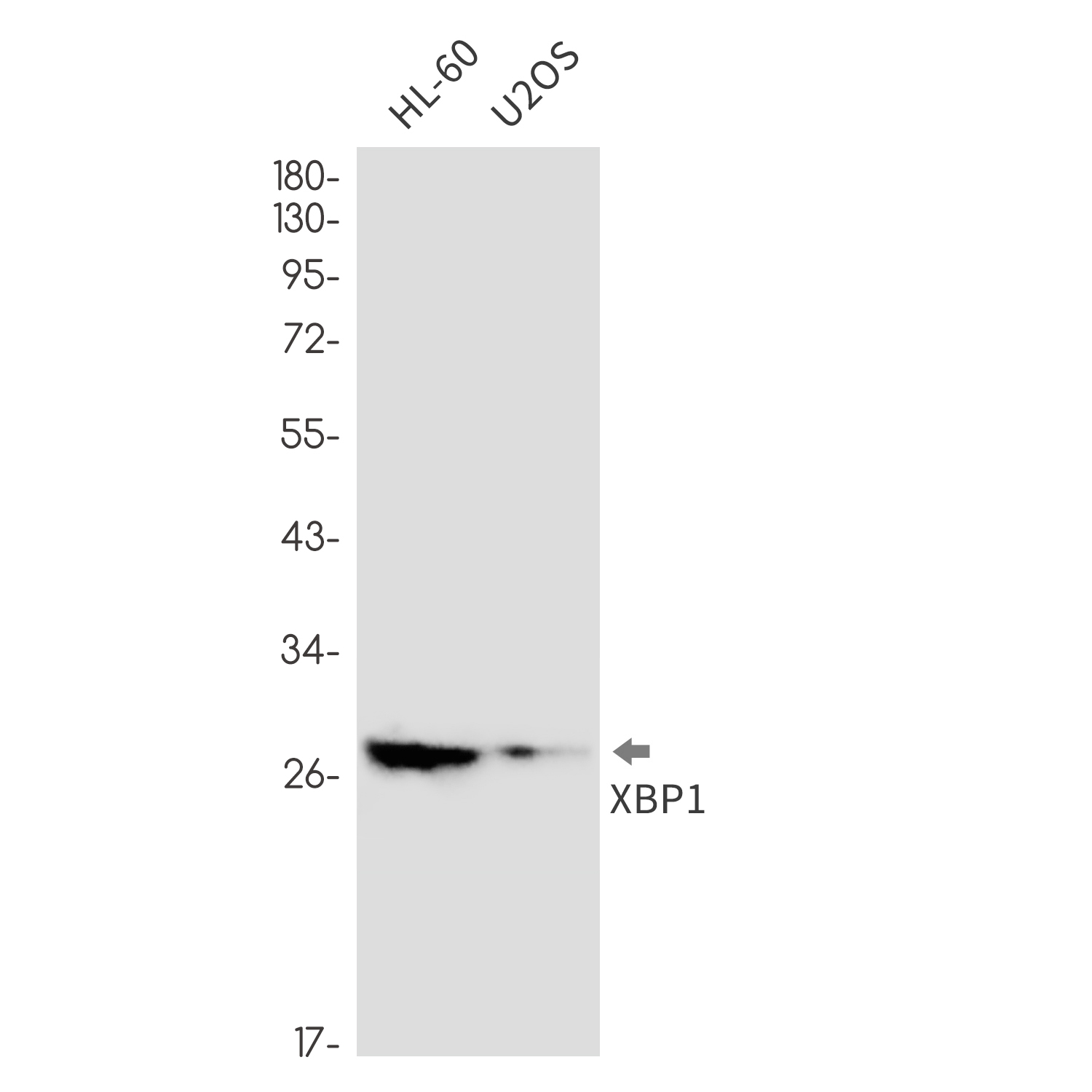 XBP1 Rabbit mAb ABZ2643