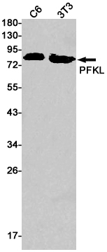 PFKL Rabbit mAb ABZ2644