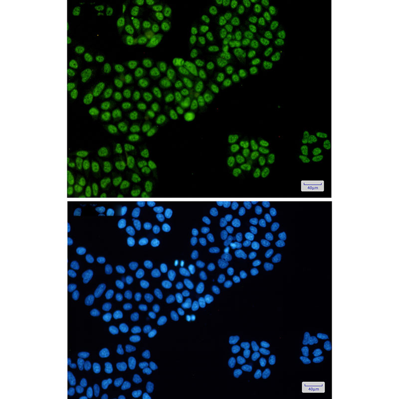 DDX5 Rabbit mAb ABZ2645