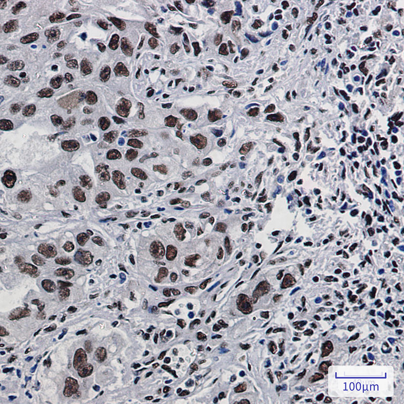 DDX5 Rabbit mAb ABZ2645