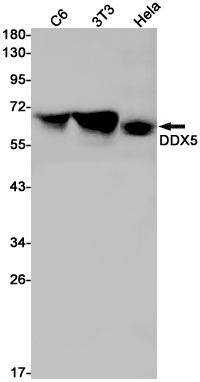 DDX5 Rabbit mAb ABZ2645