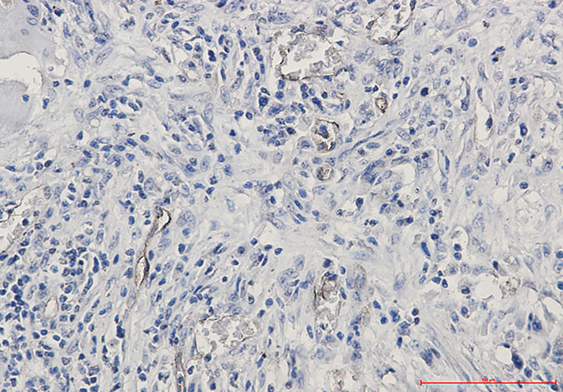 CD105 Rabbit mAb ABZ2646