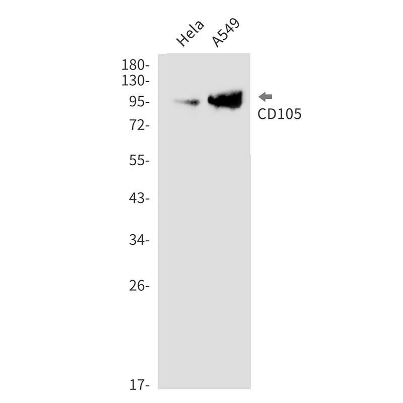 CD105 Rabbit mAb ABZ2646