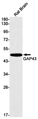 GAP43 Rabbit mAb ABZ2648