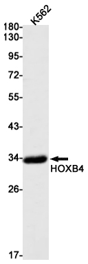 HOXB4 Rabbit mAb ABZ2649