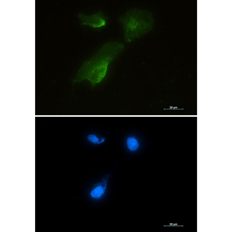 Aspartate Aminotransferase Rabbit mAb ABZ2654
