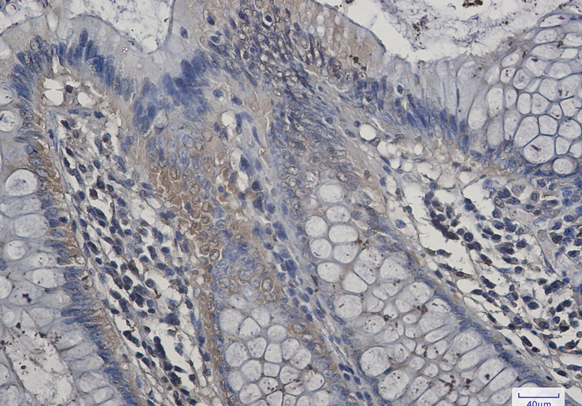 Aspartate Aminotransferase Rabbit mAb ABZ2654