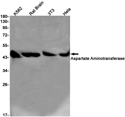 Aspartate Aminotransferase Rabbit mAb ABZ2654