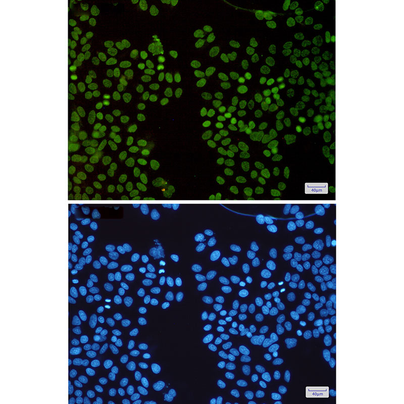 HMGA1 Rabbit mAb ABZ2655