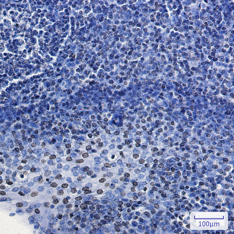 HMGA1 Rabbit mAb ABZ2655