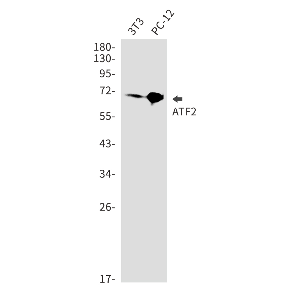 ATF2 Rabbit mAb ABZ2656