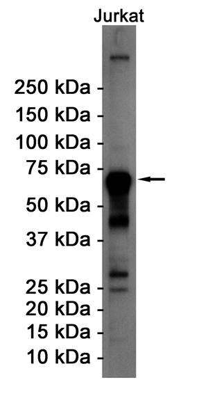 ATF2 Rabbit mAb ABZ2656