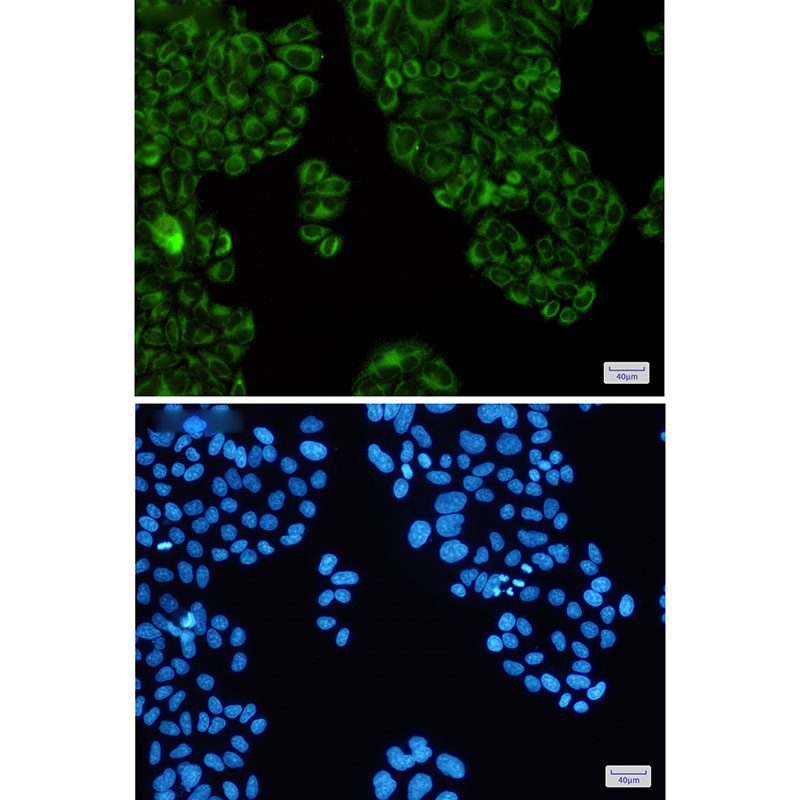 SERCA2 ATPase Rabbit mAb ABZ2657