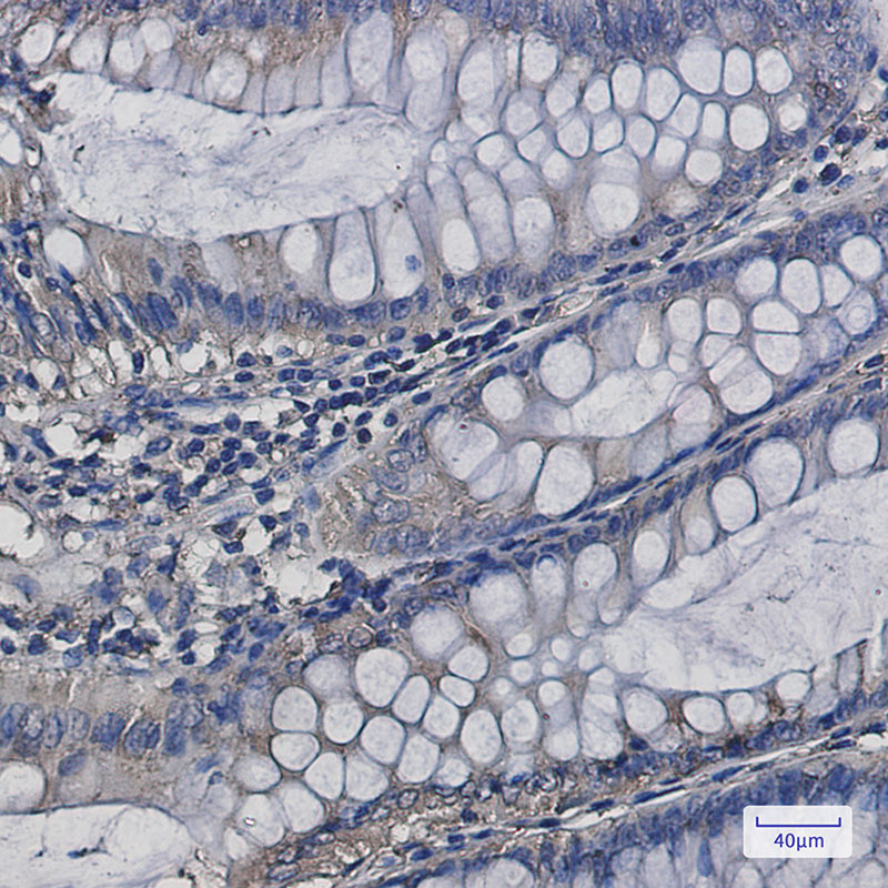 SERCA2 ATPase Rabbit mAb ABZ2657
