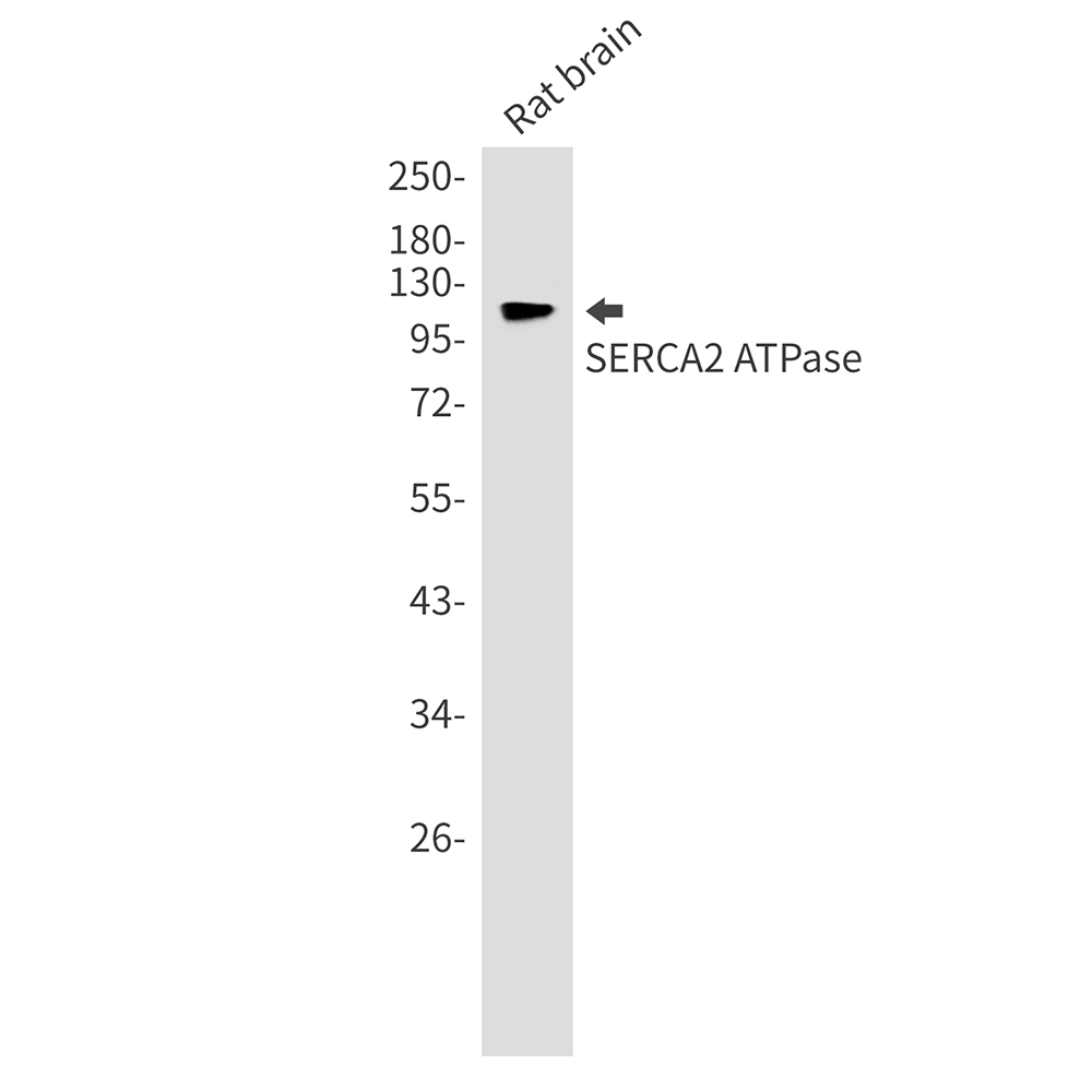 SERCA2 ATPase Rabbit mAb ABZ2657