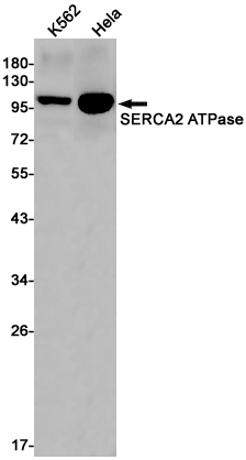 SERCA2 ATPase Rabbit mAb ABZ2657