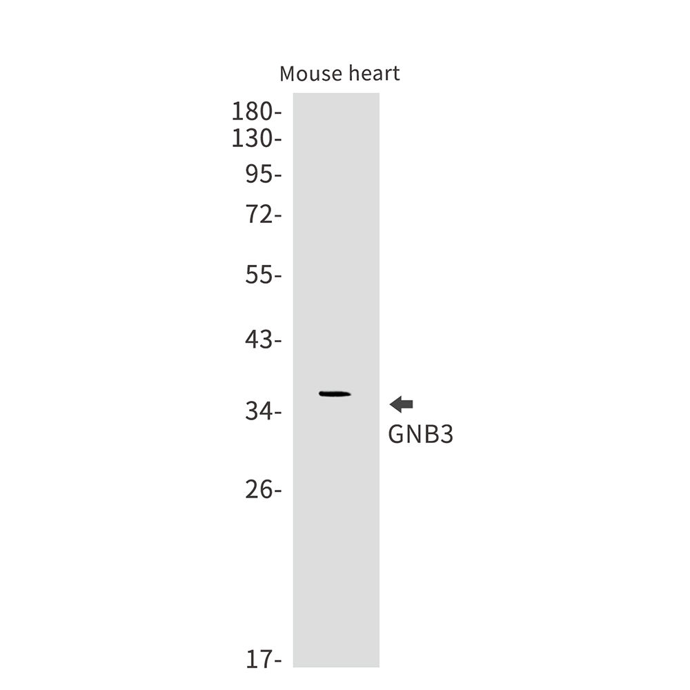 GNB3 Rabbit mAb ABZ2658