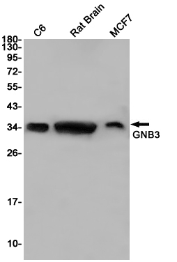 GNB3 Rabbit mAb ABZ2658