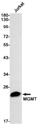 MGMT Rabbit mAb ABZ2659