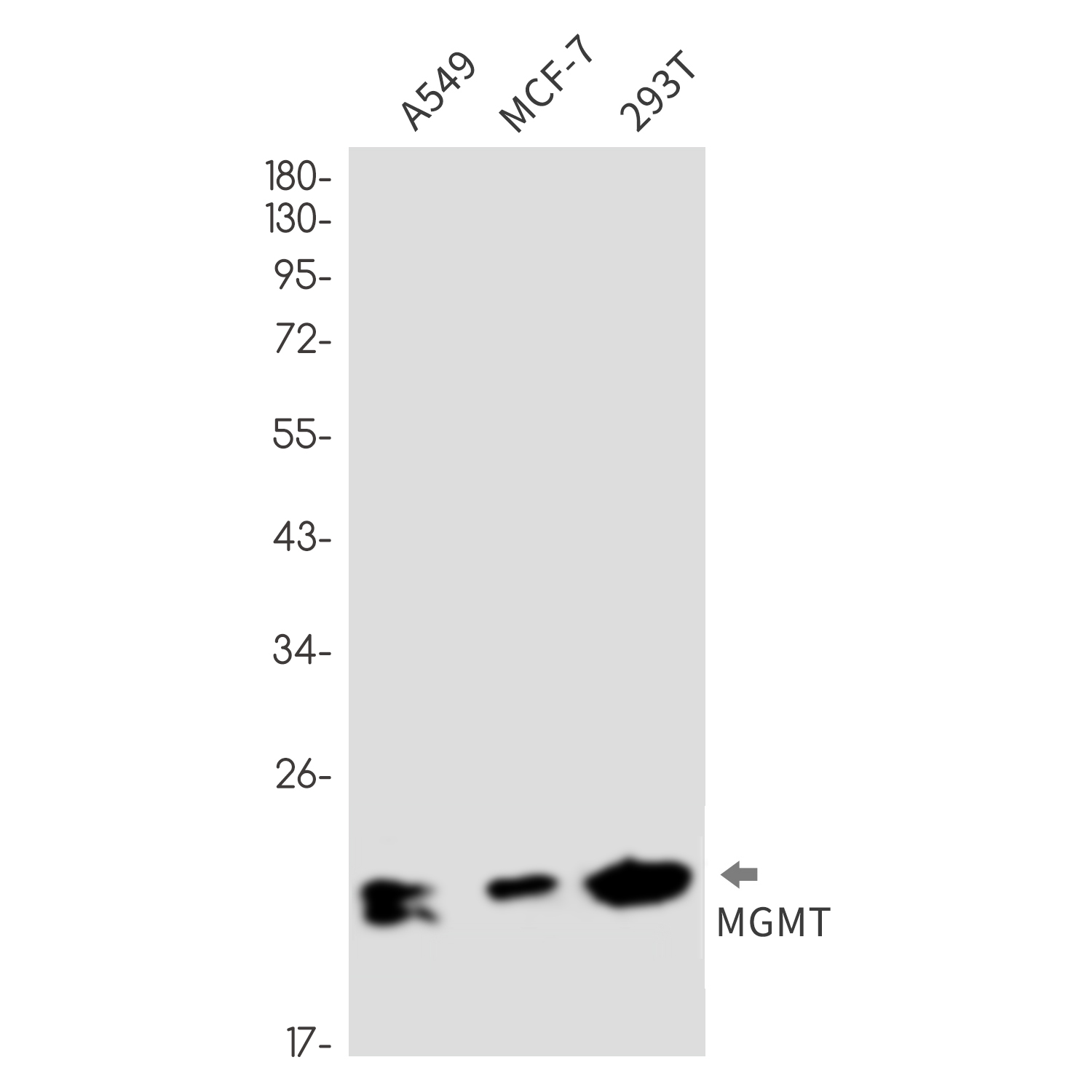 MGMT Rabbit mAb ABZ2660