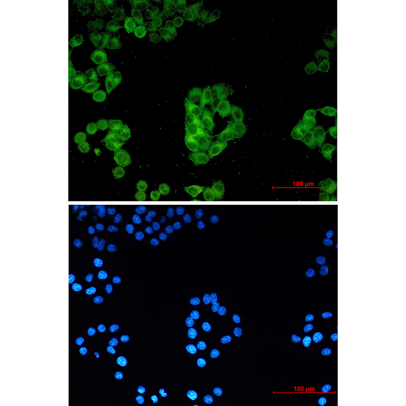 Cytochrome P450 Reductase Rabbit mAb ABZ2661
