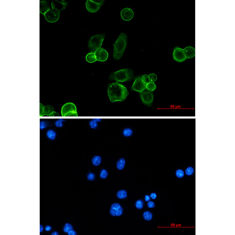 EpCAM Rabbit mAb ABZ2662