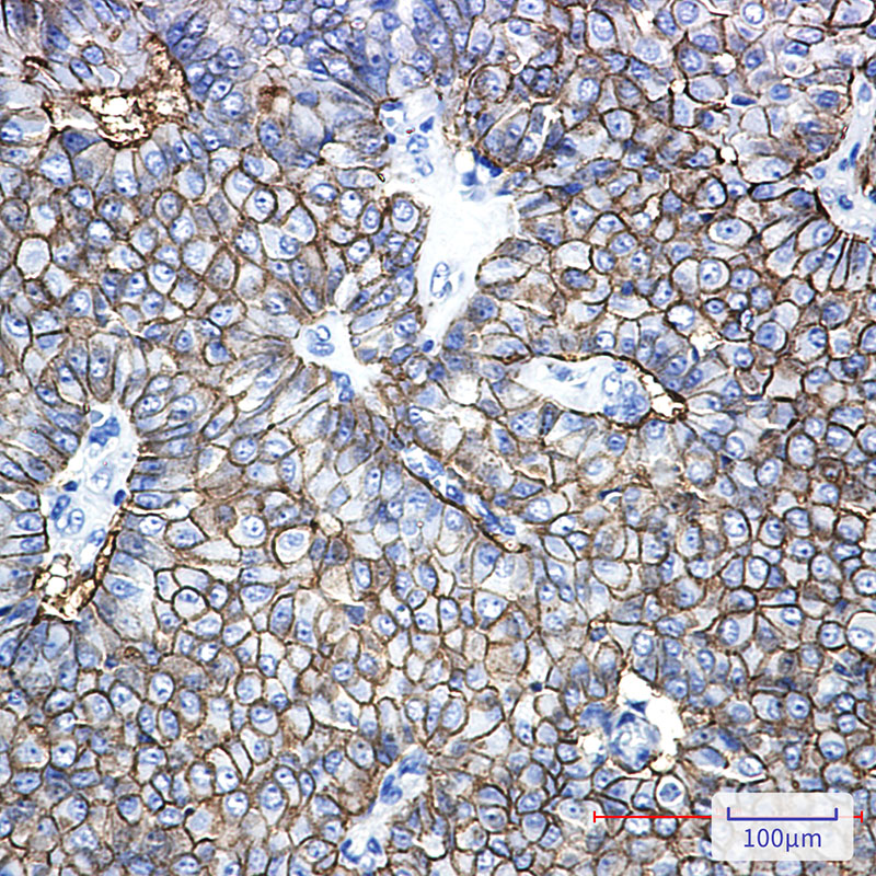 EpCAM Rabbit mAb ABZ2662