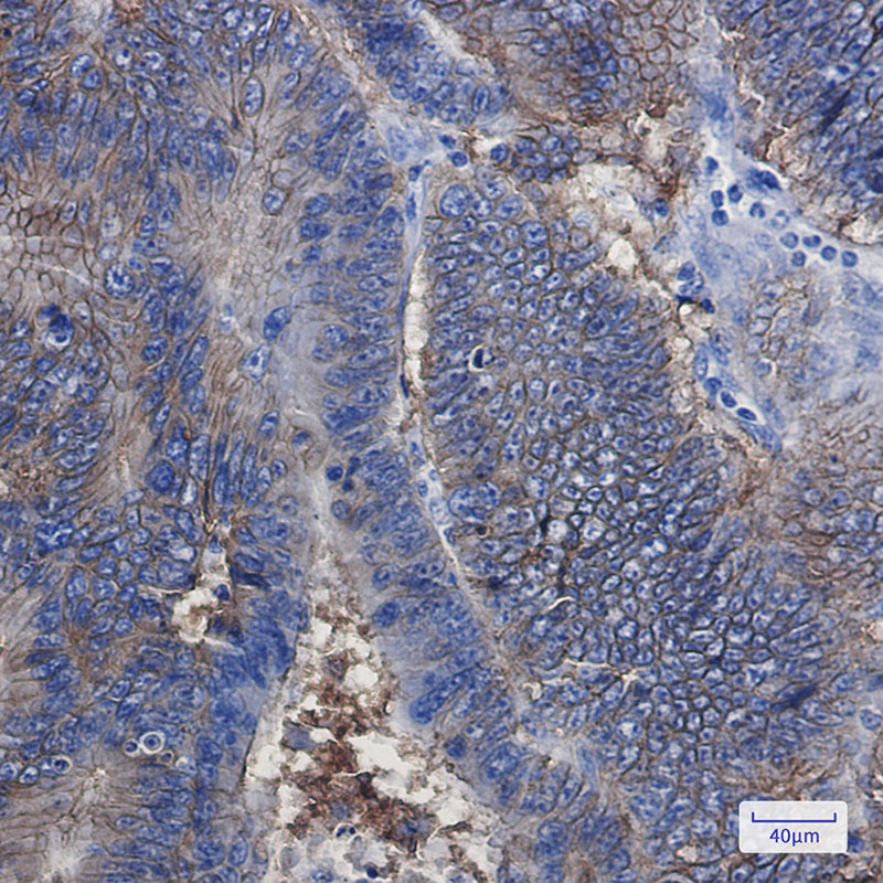 EpCAM Rabbit mAb ABZ2663