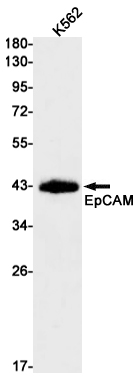 EpCAM Rabbit mAb ABZ2663