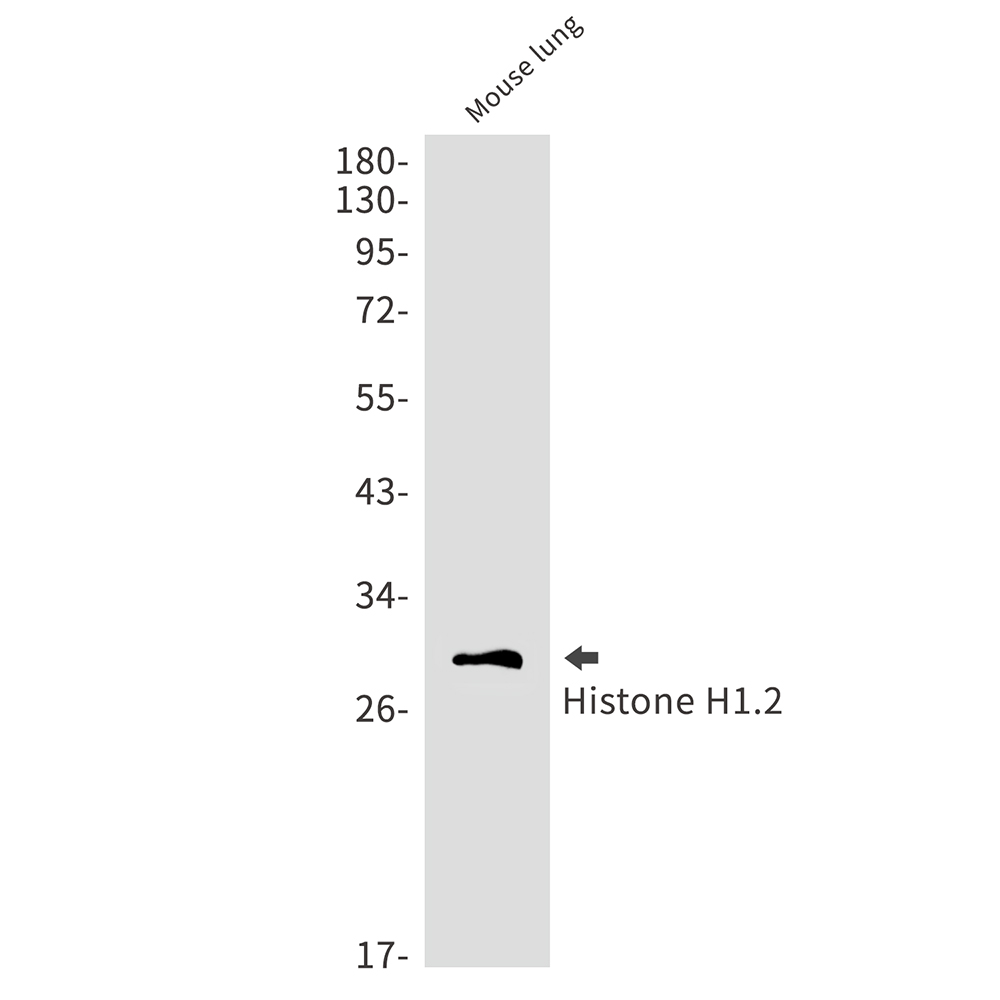 Histone H1.2 Rabbit mAb ABZ2664