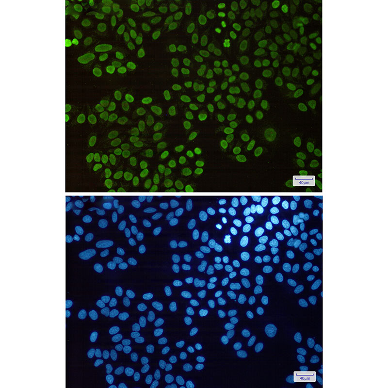 Histone H1.3 Rabbit mAb ABZ2665