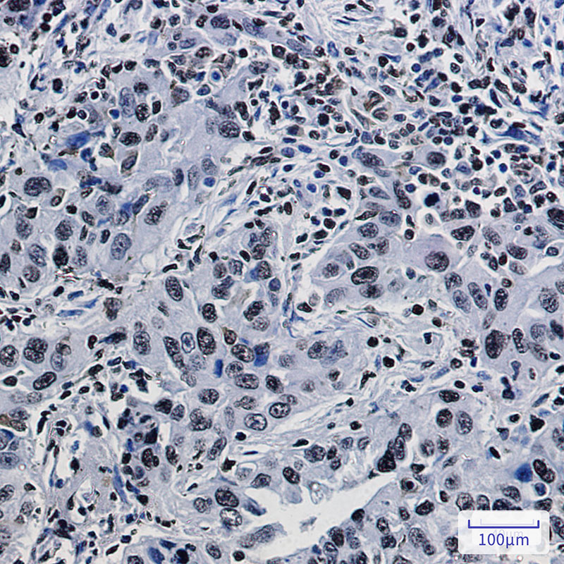 Histone H1.3 Rabbit mAb ABZ2665