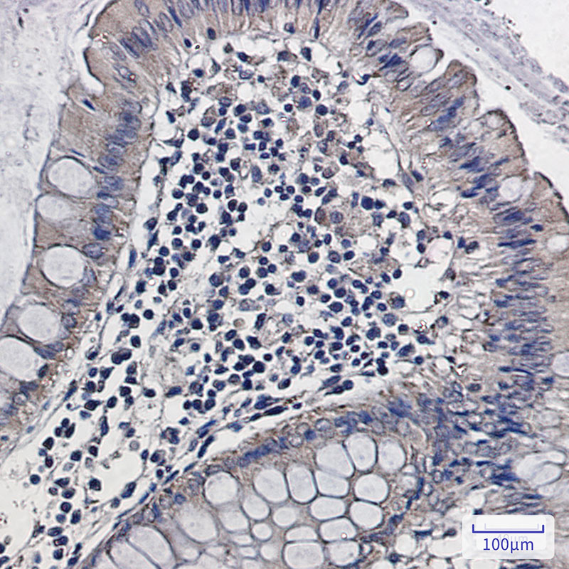 ALDH2 Rabbit mAb ABZ2666