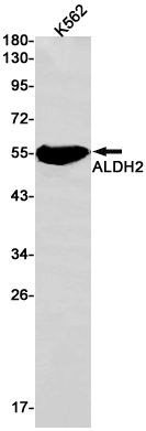ALDH2 Rabbit mAb ABZ2666
