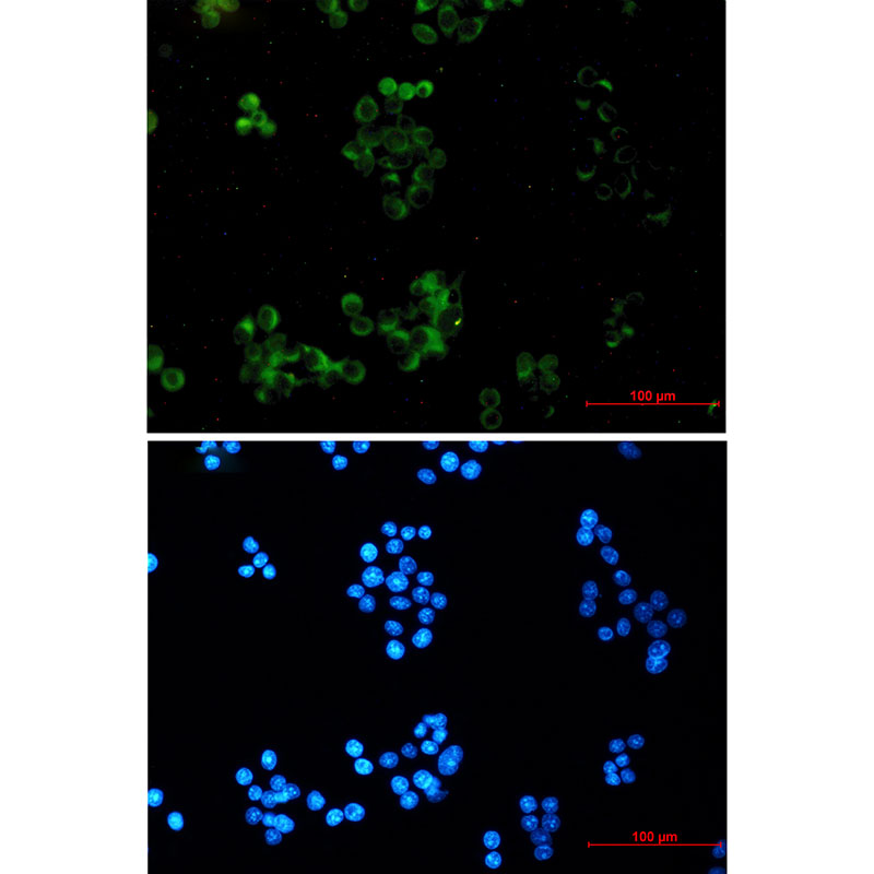 Amyloid Precursor Protein Rabbit mAb ABZ2667