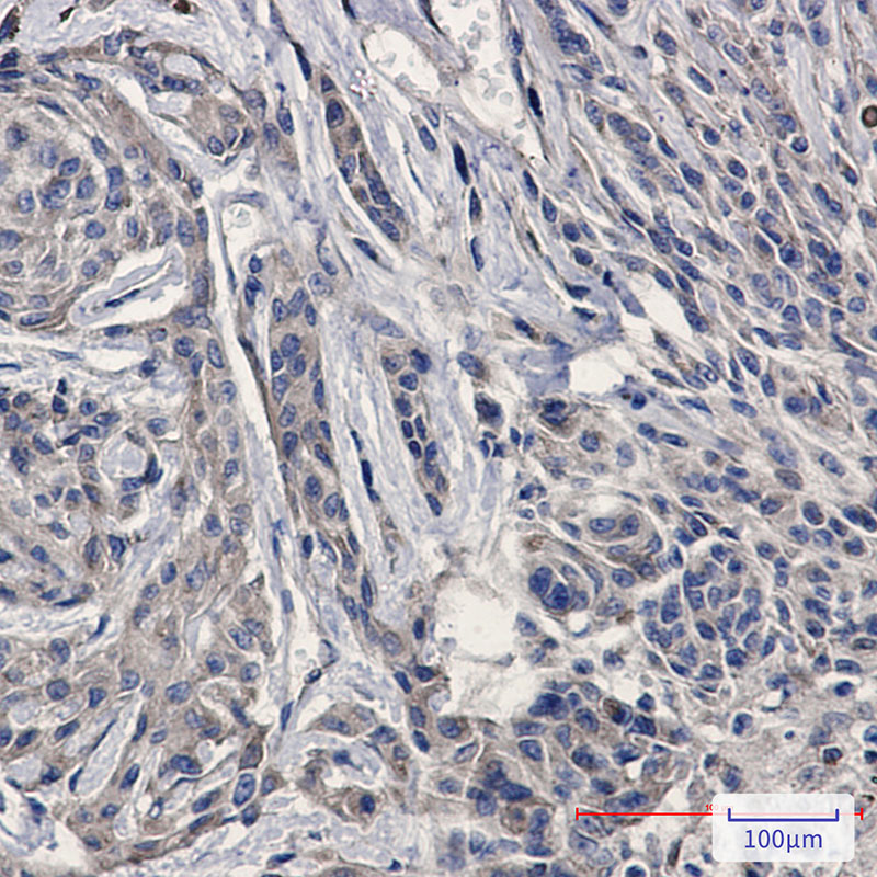Amyloid Precursor Protein Rabbit mAb ABZ2667