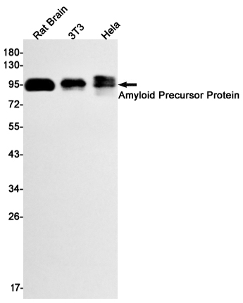 Amyloid Precursor Protein Rabbit mAb ABZ2667