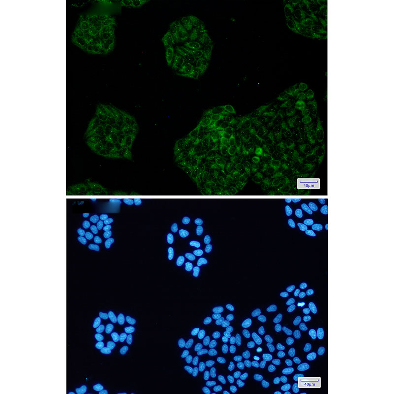 Amyloid Precursor Protein Rabbit mAb ABZ2668