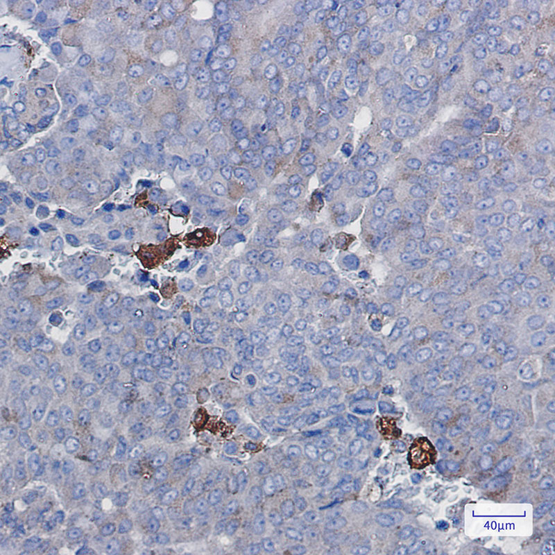 Amyloid Precursor Protein Rabbit mAb ABZ2668