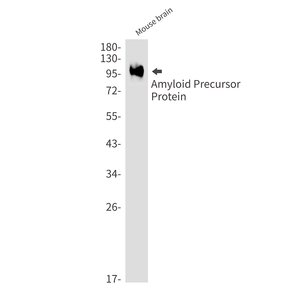 Amyloid Precursor Protein Rabbit mAb ABZ2668